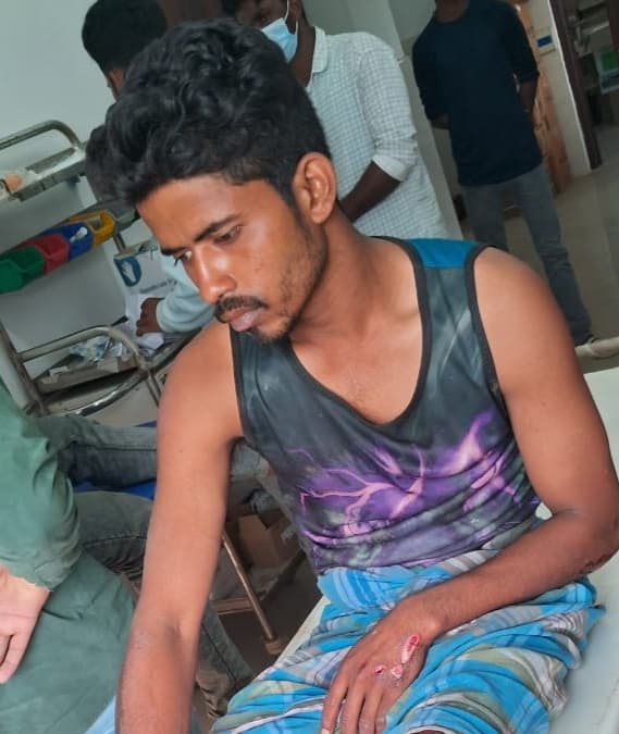 दो बाइकों की टक्कर में बाइक सवार समेत तीन व्यक्ति घायल