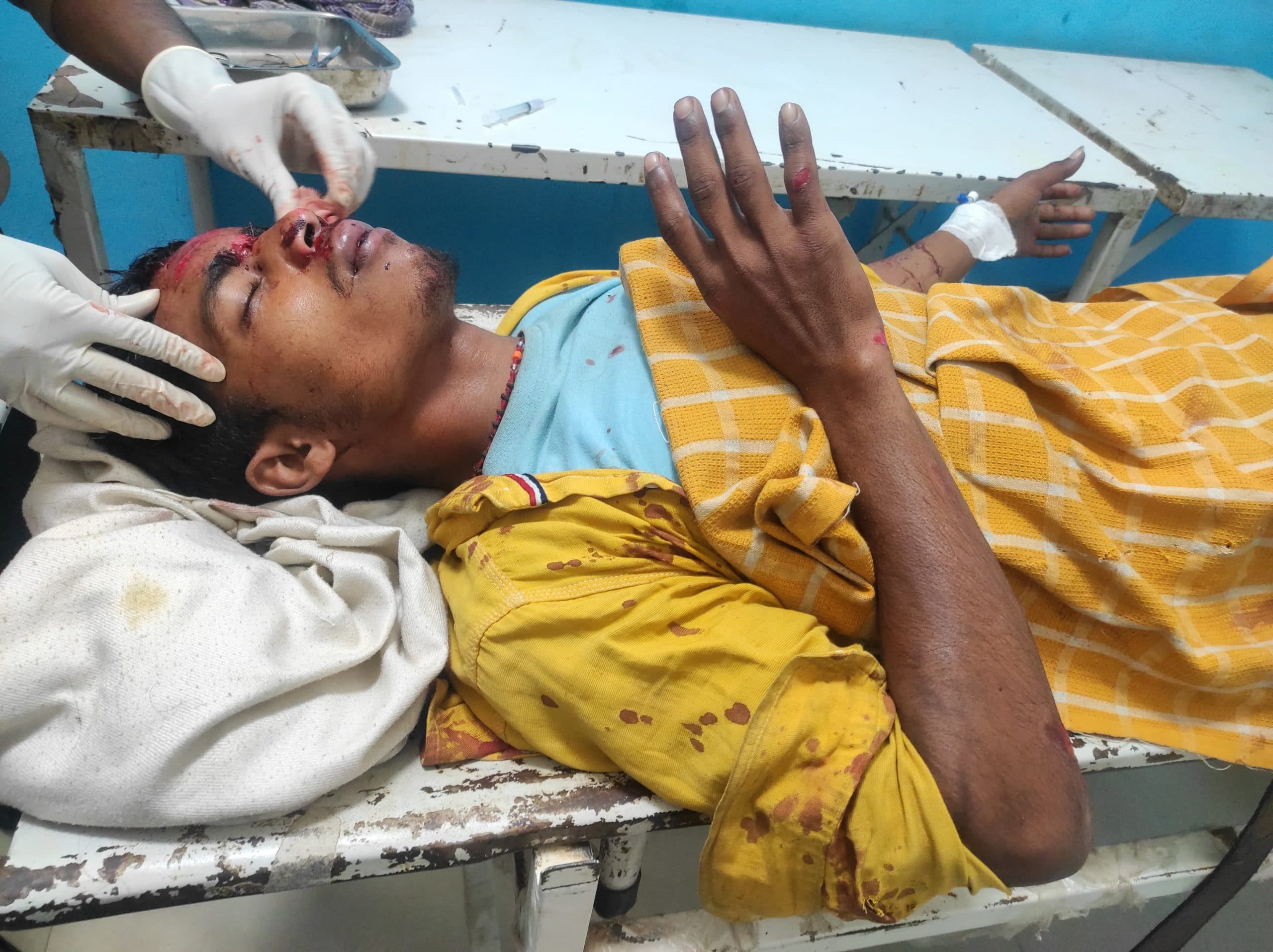 ट्रक की ठोकर से परीक्षा देने जा रहे बाइक सवार तीन छात्र जख्मी, एक गंभीर