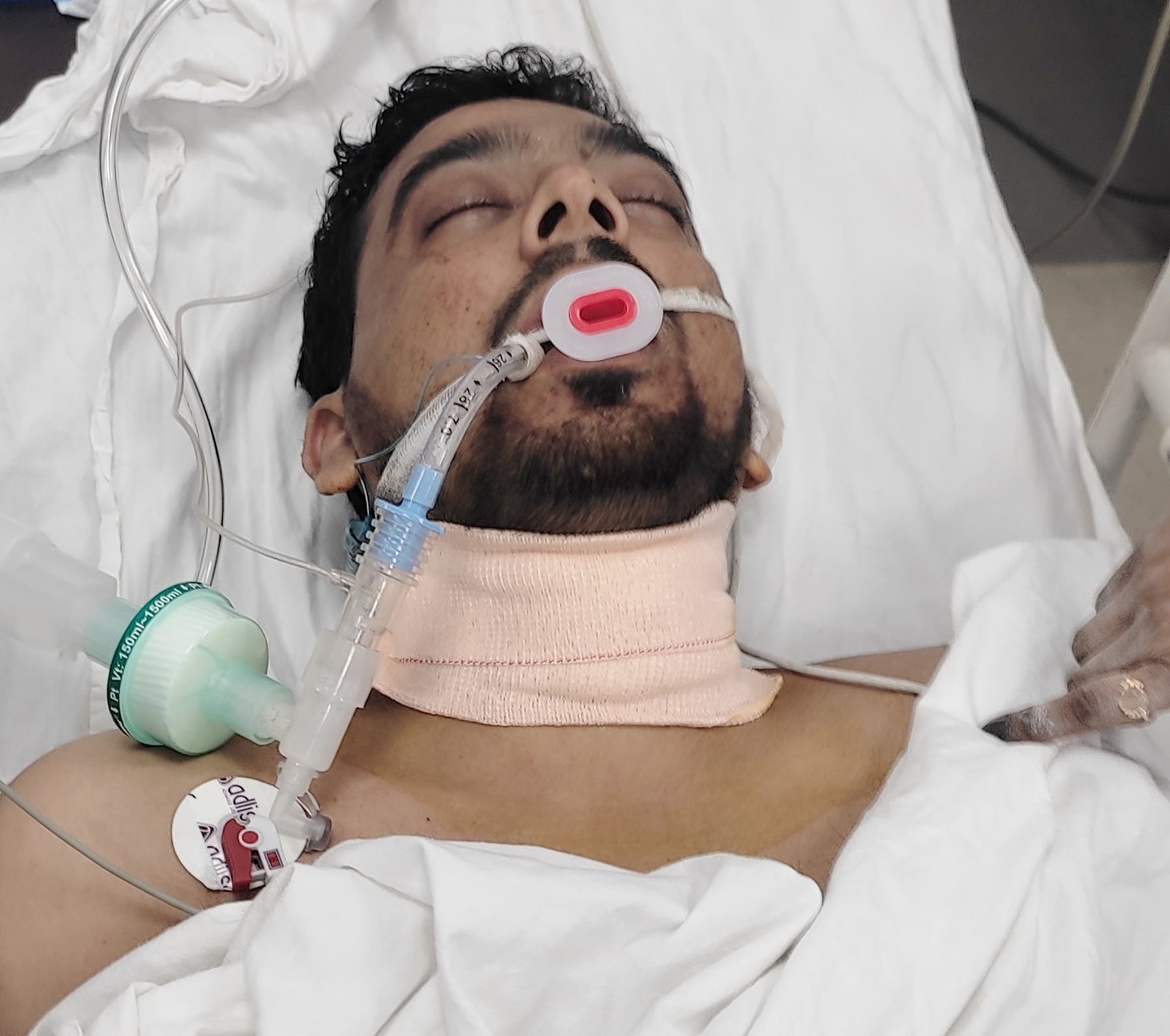 Jamshedpur News : आजादनगर : युवक ने खुद का गला रेता, हालत गंभीर