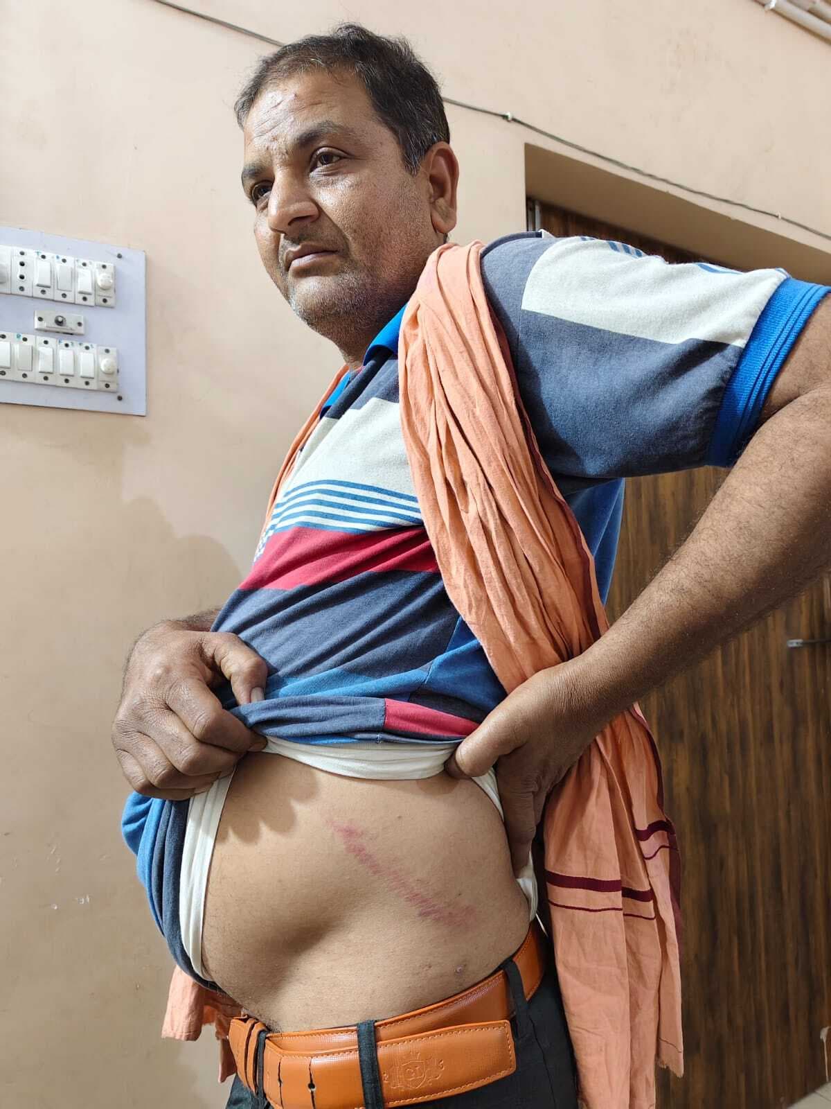 वाहन चेकिंग के दौरान डीटीओ से मारपीट, दी जान मारने की धमकी