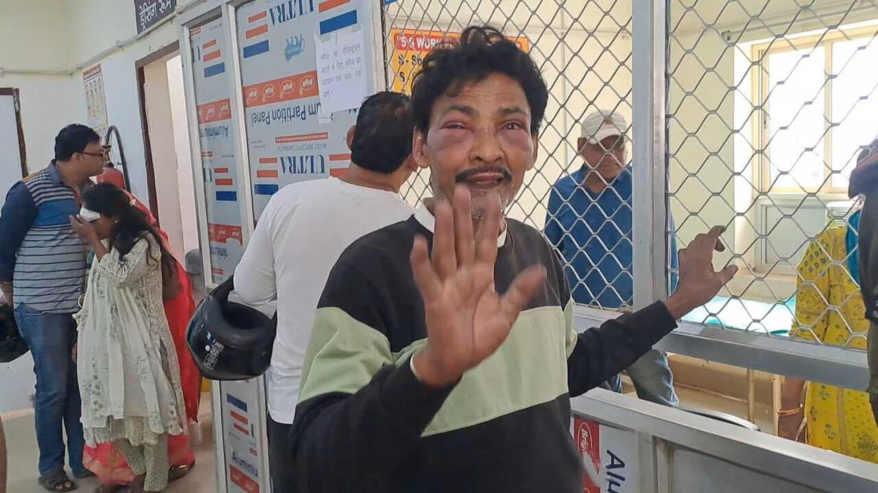 आठ माह बाद तथाकथित अपहृत लौटा गांव, चोर समझ कर ग्रामीणों ने बुरी तरह पीटा