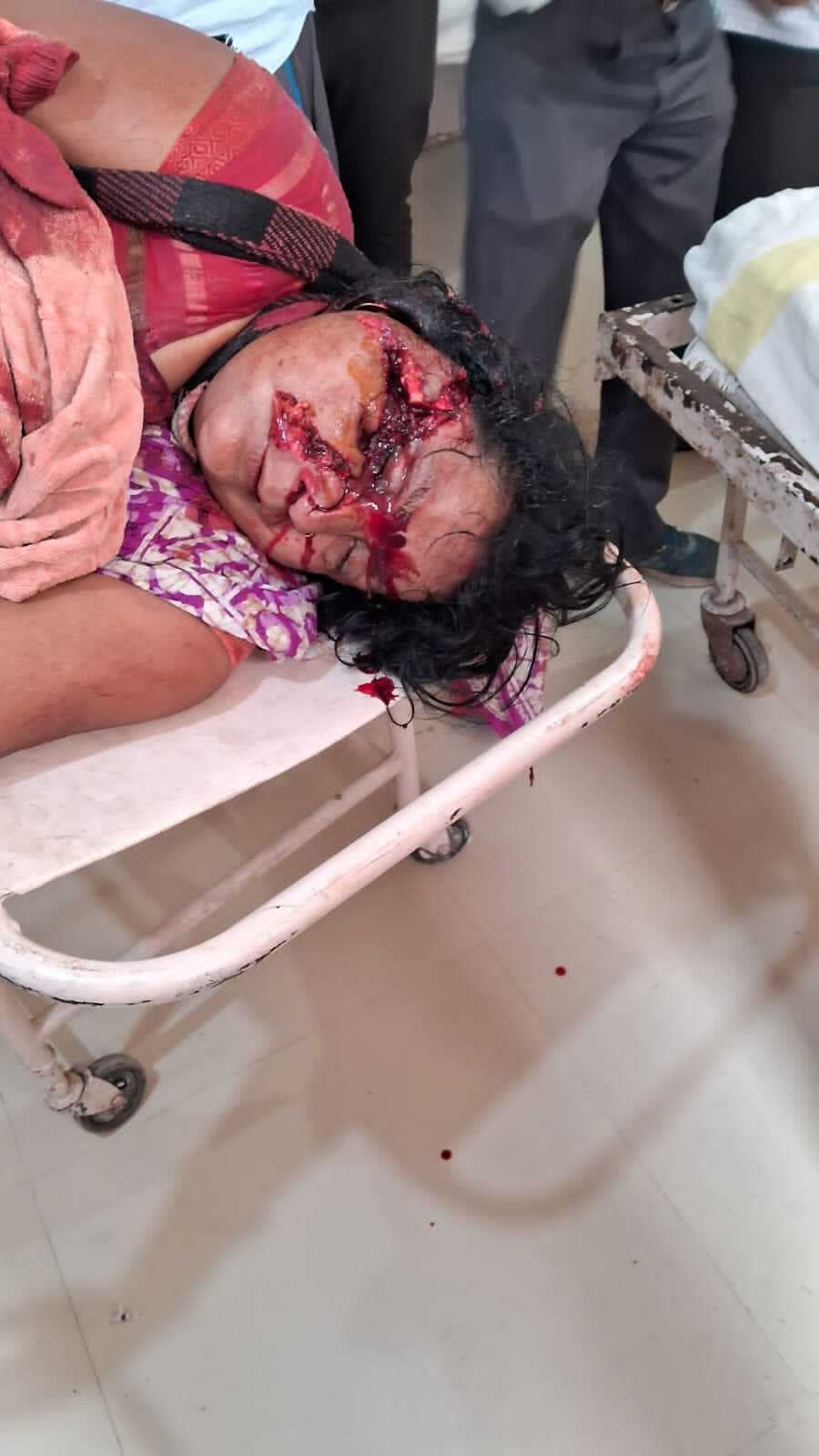 घर में घुसकर महिला को मारी गोली, भागलपुर रेफर