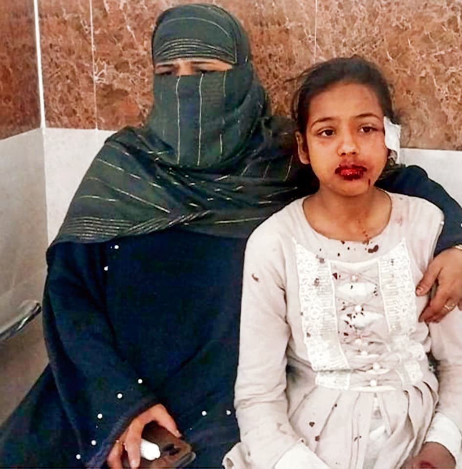 Siwan News : कार ने बाइक सवार सहित चार लोगों को रौंदा, एक की मौत