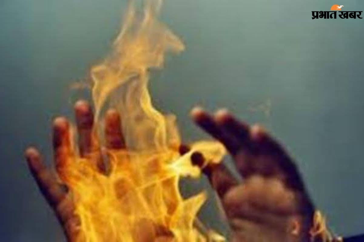 Bihar News: लाइक और व्यूज के लिए मौत का खेल, दरभंगा में पेट्रोल डालकर युवक को जलाया