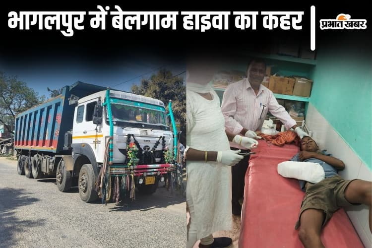 Bihar News: भागलपुर में बेलगाम हाइवा का कहर, किशोर का दाहिना हाथ हुआ चूर, JLNMCH रेफर