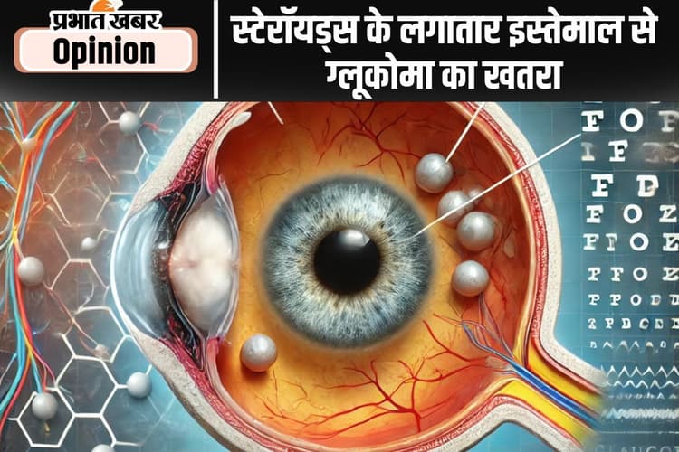 स्टेरॉयड्स से ग्लूकोमा