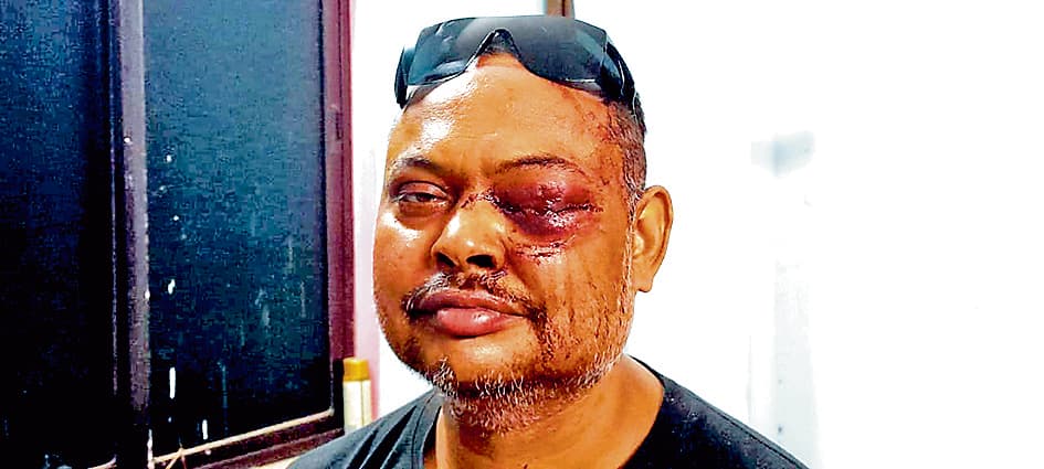 शिवपुर : महंगा पड़ गया बकाया मांगना, ग्राहक ने फोड़ दी आंख