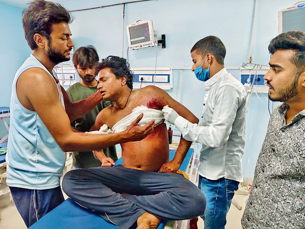 जगदीशपुर में संदेहास्पद स्थिति में युवक को लगी गोली, गंभीर