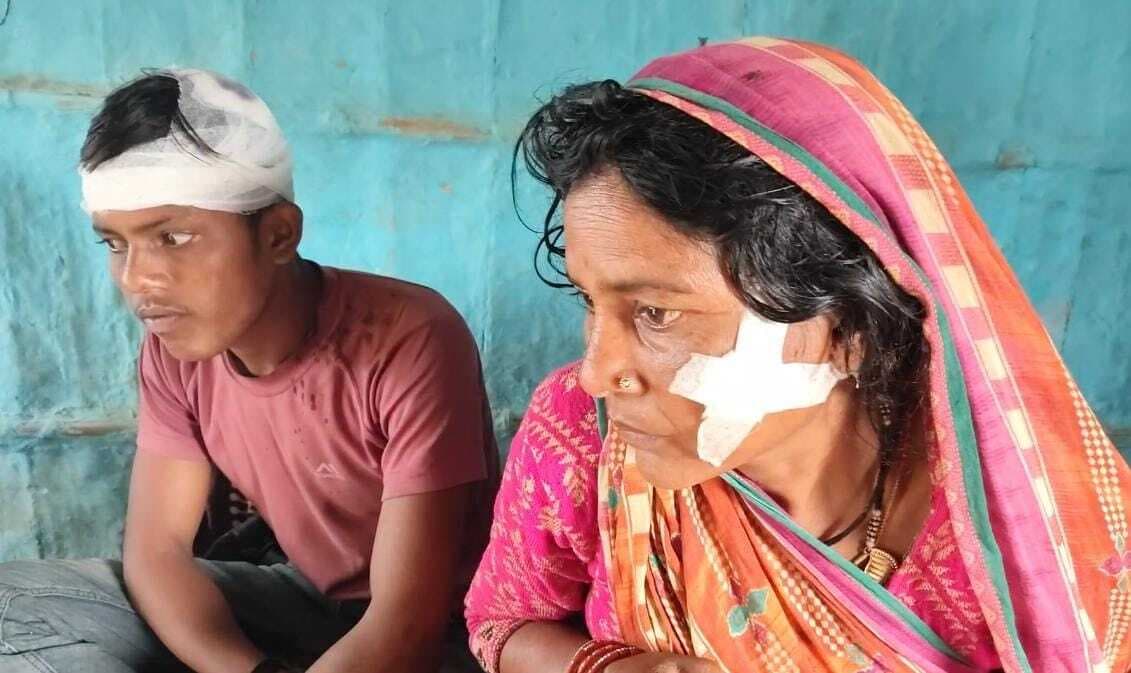 पुरानी रंजिश को लेकर दो पक्षो के बीच जमकर हुई मारपीट, चार लोग हुए जख्मी