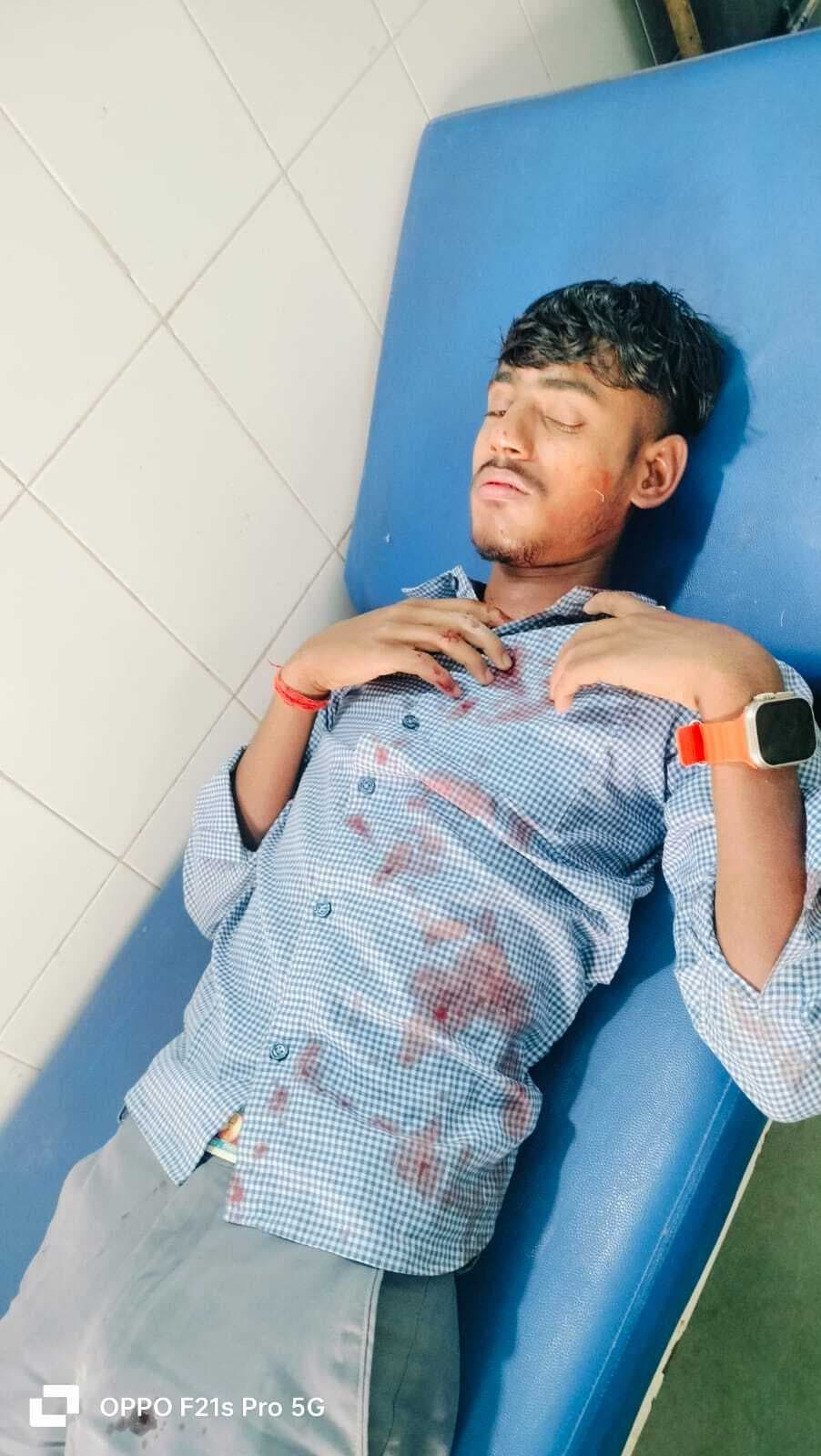 Giridih News :सड़क हादसे में तीन विद्यार्थी जख्मी