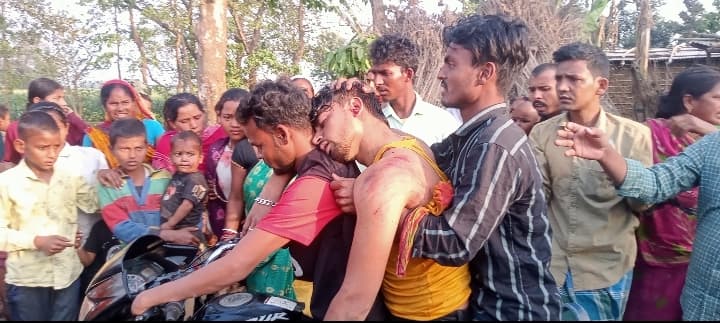 दो बाइक की टक्कर में युवक गंभीर, रेफर