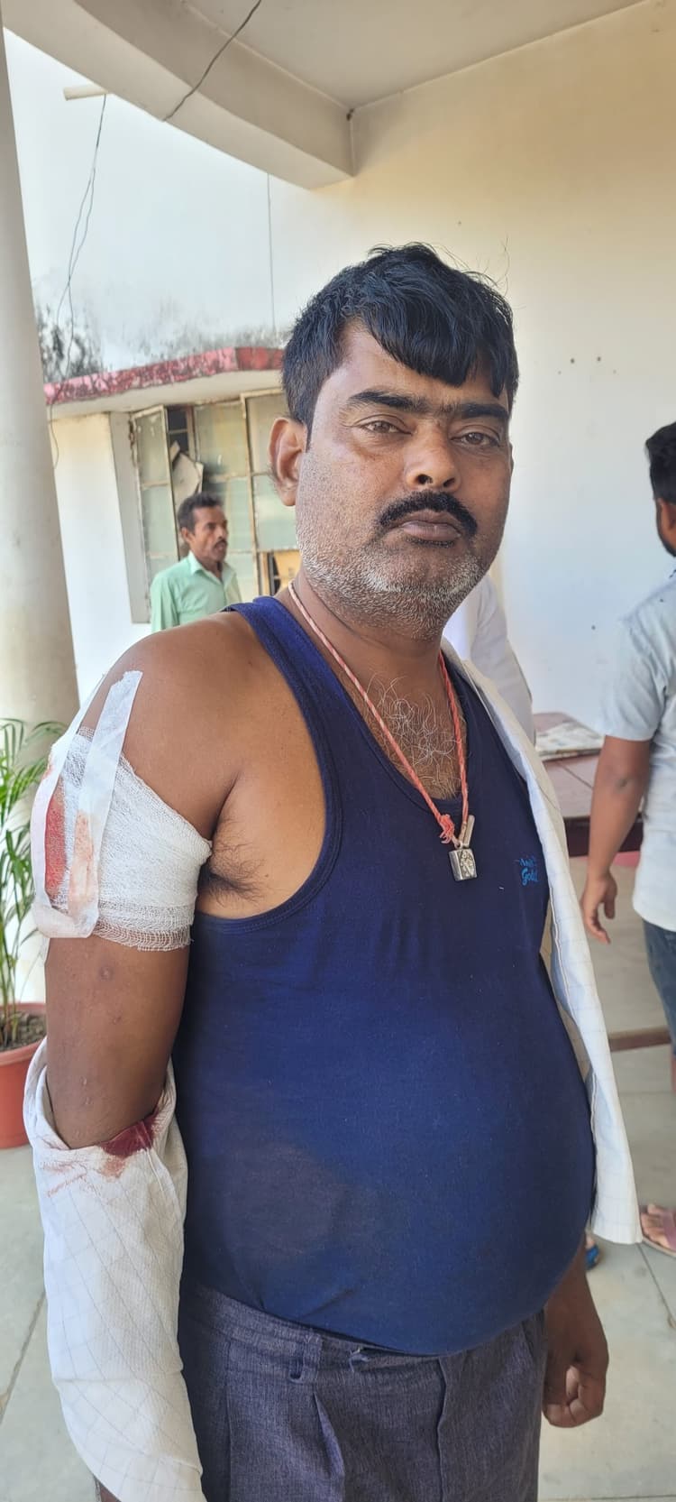 Deoghar News : बकरी लदे पिकअप वैन चालक को मारी गाेली, 55 हजार व मोबाइल लूट कर भागे अपराधी