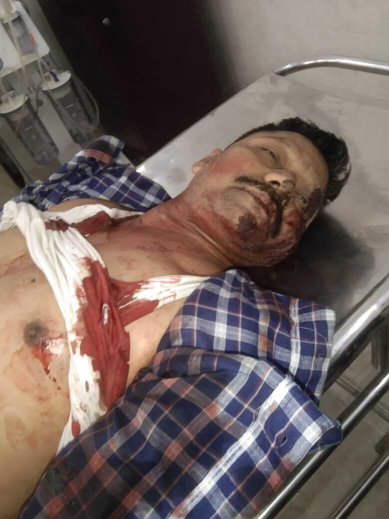 Chaibasa News : फोन पर बात कर रहे युवक को बस ने कुचला, मौत