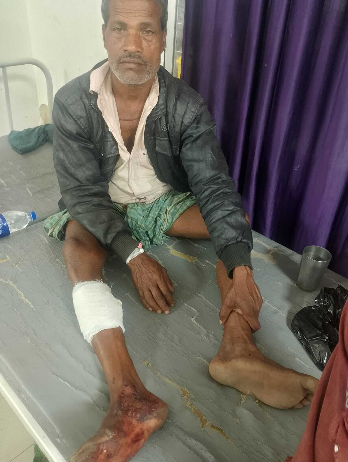 जमीन विवाद को ले दो पक्षों में गोलीबारी, एक जख्मी