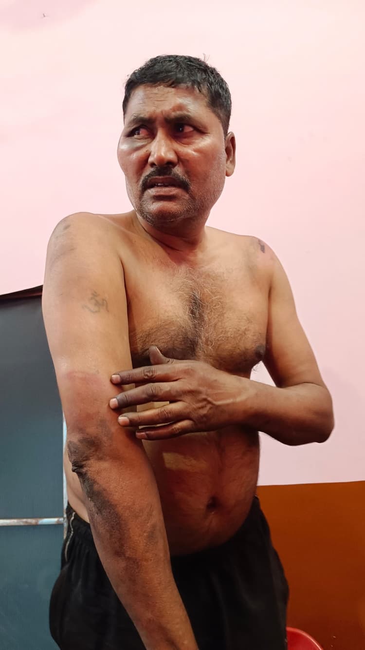 Bokaro News : कोयला तस्करों के दो गुट भिड़े, मारपीट, फायरिंग, एक घायल