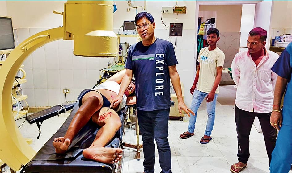 25 हजार के इनामी अपराधी सहित तीन को मारी गोली, एक की गयी जान