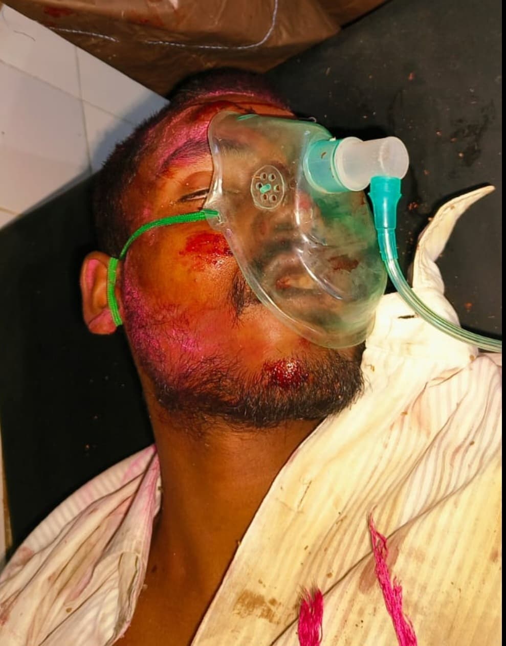 West Singhbhum News : पिकअप वैन ने स्कूटी में धक्का मारा, चार युवक गंभीर, रेफर