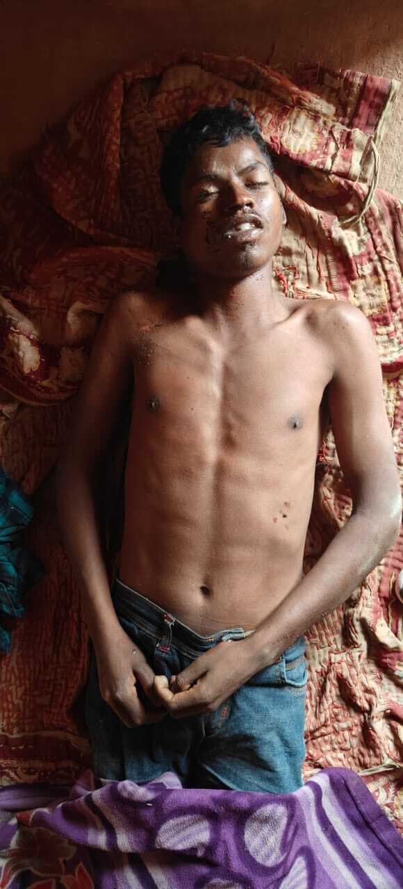 Chaibasa News : जमीन विवाद में बड़े पिता व चचेरे भाई ने किशोर को पीटा, मौत