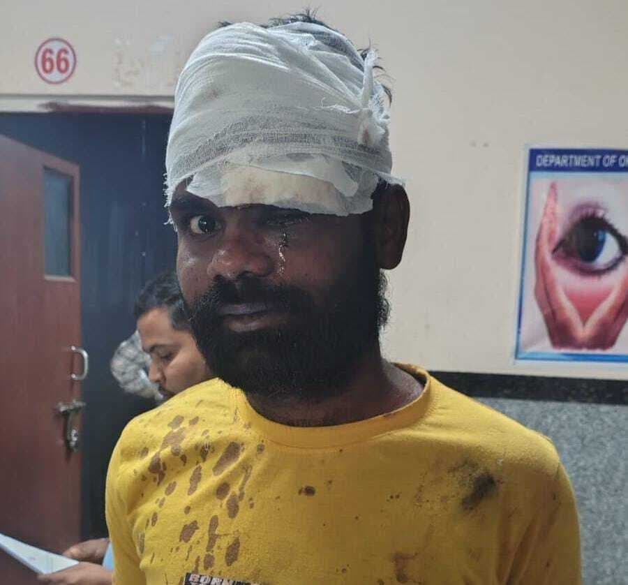 युवक पर जानलेवा हमला, फूटी आंख