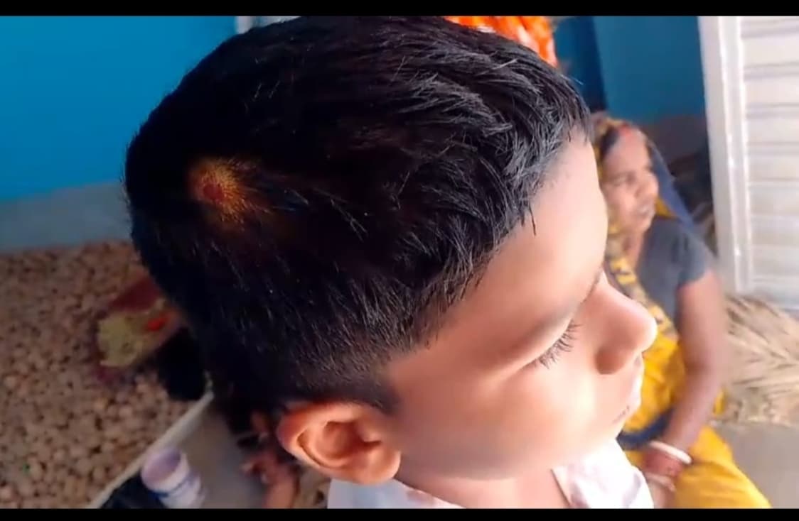 छात्र की पिटाई करने पर प्रधानाध्यापक पर प्राथमिकी दर्ज