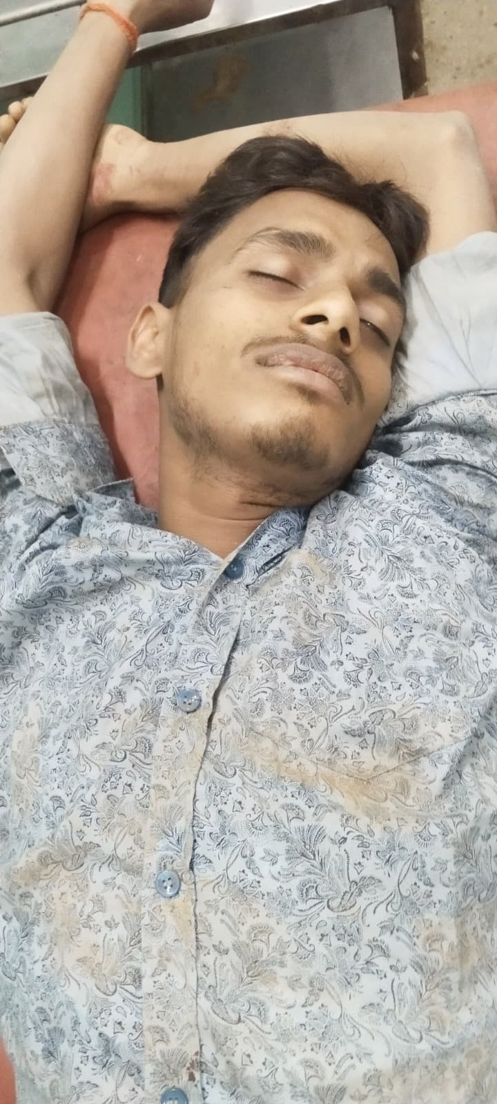 दही गोप का शूटर हुआ गिरफ्तार, एसटीएफ से मुठभेड़ में पैर में लगी गोली