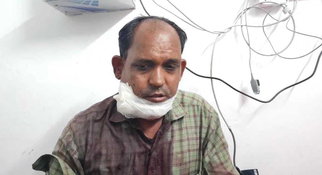 Dhanbad News: तोपचांची के फल व्यवसायी को मारी गोली, हालत गंभीर