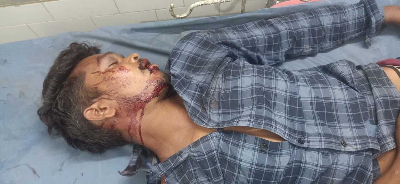 East Singhbhum News : धालभूमगढ़ के कोकपाड़ा में एनएच पार कर रहे दो लोगों को पिकअप वैन ने कुचला , मौत