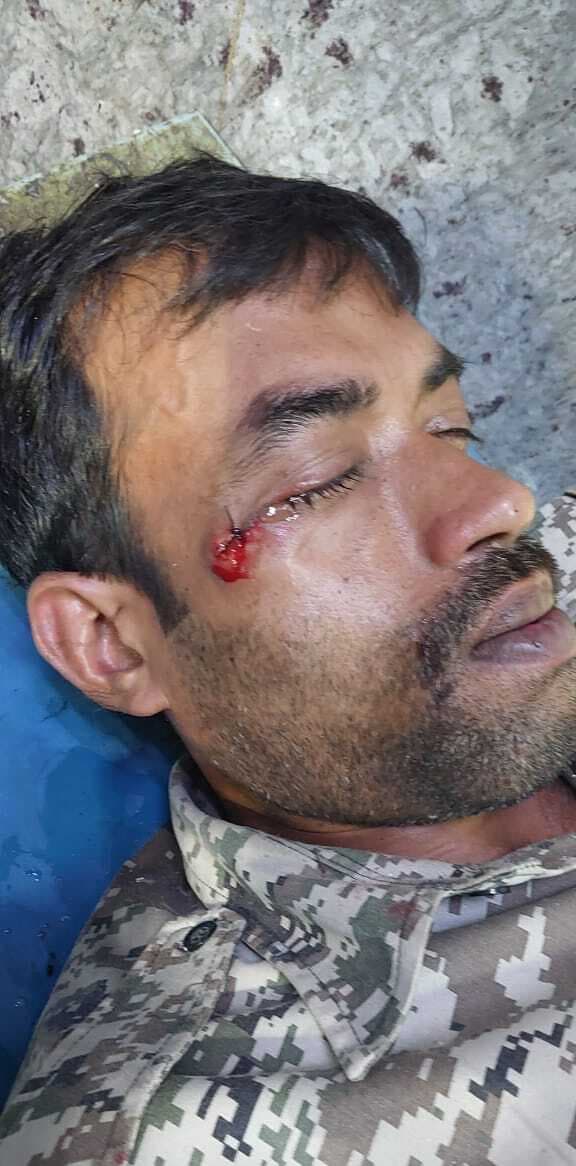 East Singbhum News : ग्रामीणों ने होमगार्ड जवान को बनाया बंधक, बचाने गयी पुलिस पर पथराव, कांस्टेबल घायल