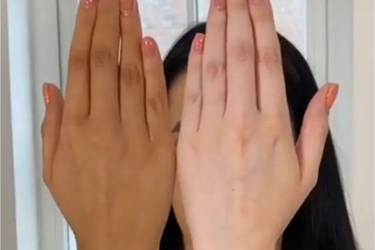 Hand Tanning Home Remedies: टैनिंग को कहें बाय-बाय, इन घरेलू नुस्खों से पाएं गोरे और चमकदार हाथ