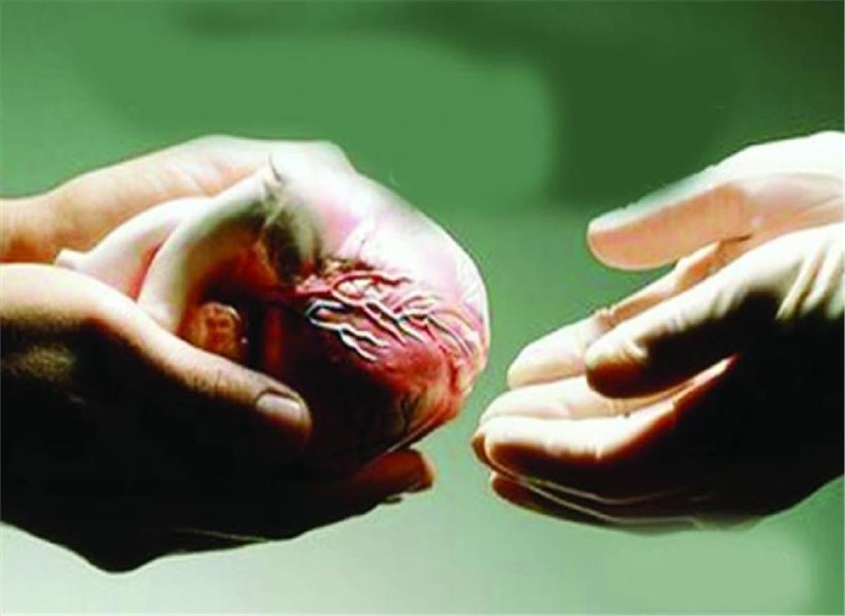 एक बिहारी के देहदान से छह गुजरातियों को मिला नया जीवन, किसी ने किडनी तो किसी ने लिया लीवर