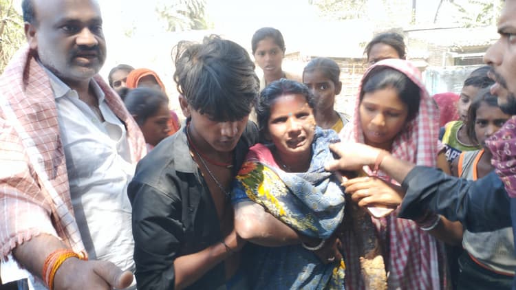 Samastipur News:रोसड़ा के रहुआ में चार घर जले, महिला झुलसी