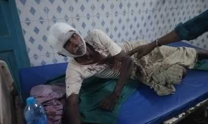 पटवन के विवाद में मारपीट, महिला समेत चार लोग घायल