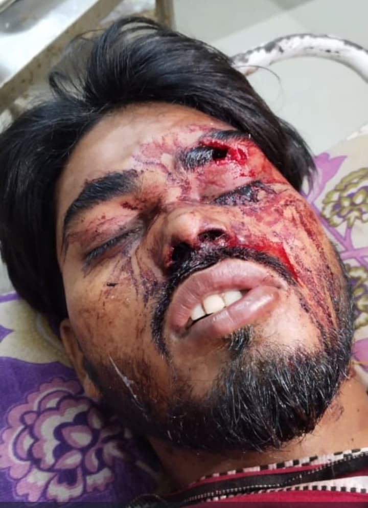 दो बाइक की टक्कर में युवक गंभीर रूप से जख्मी