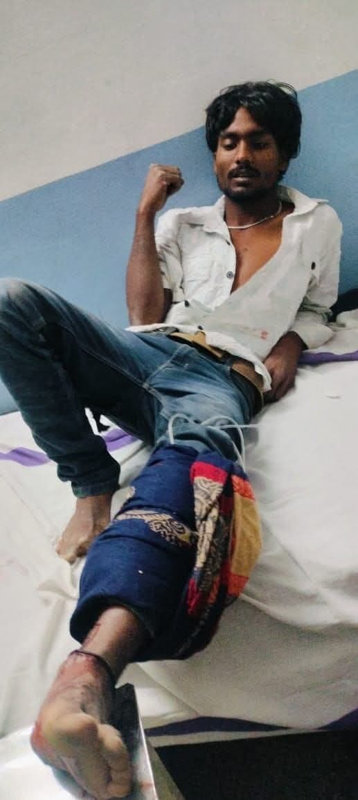 Motihari news :छह अपराधियों ने युवक को घेरकर पैर में मारी गोली