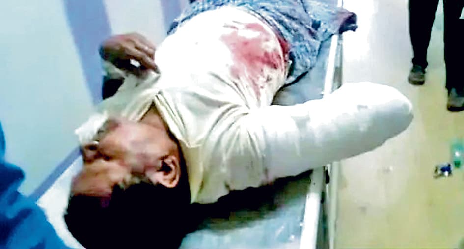 बस की खिड़की से बाहर थे दो लोगों के हाथ, कट गये