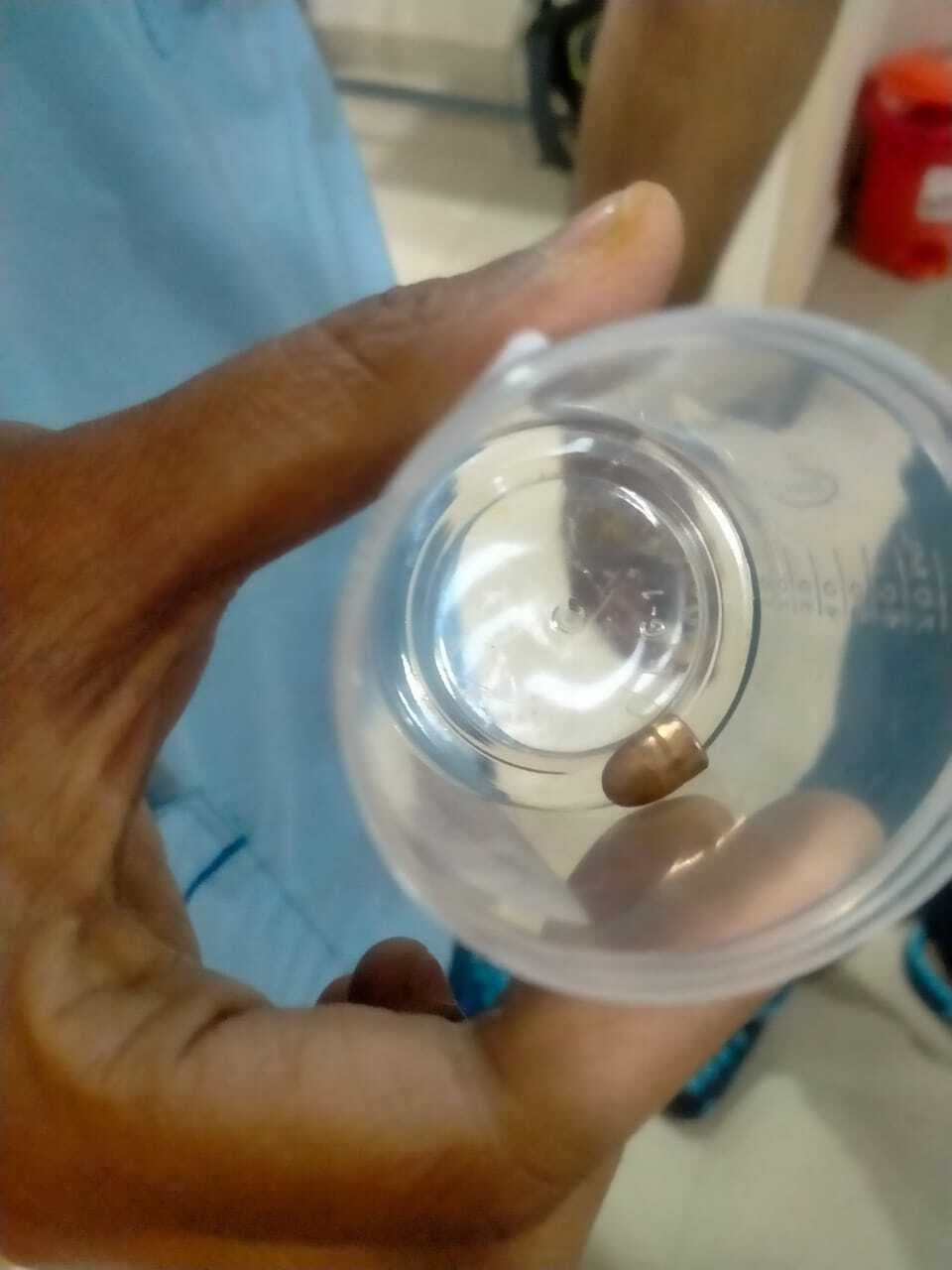 deoghar news : घायल मृत्युंजय के शरीर से निकाली गयी गोली, हालत खतरे से बाहर