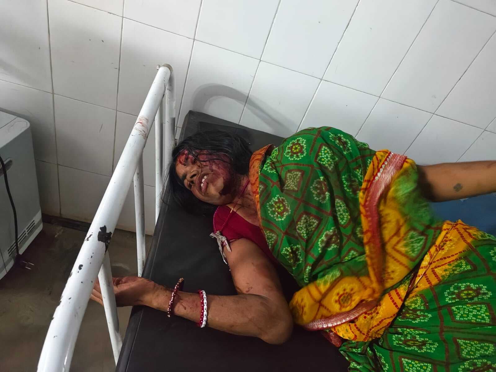 धारदार हथियार से हमला कर दंपती को किया घायल, भर्ती