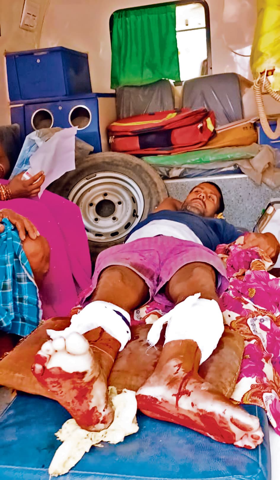 Saran News : मछली के विवाद में युवक को फरसा से मारकर किया घायल