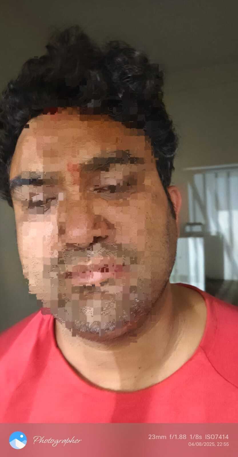 hajipur news . एटीएम फ्रेंचाइजी संचालक के बेटे से पांच लाख रुपये लूट का मुख्य आरोपित गिरफ्तार