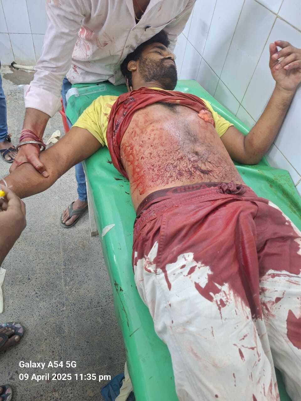 Samsatipur : वार्ड पार्षद के पति को अपराधियों ने मारी गोली, रेफर