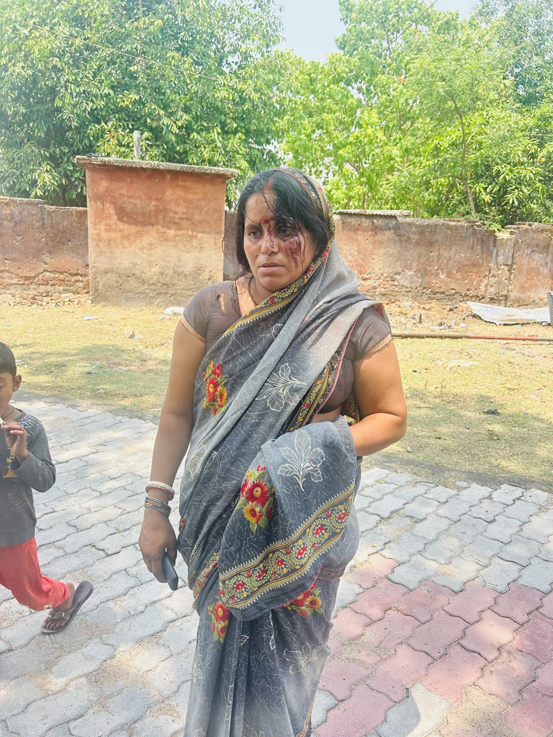 Giridih News : महिला ने ससुराल वालों पर लगाया मारपीट का आरोप