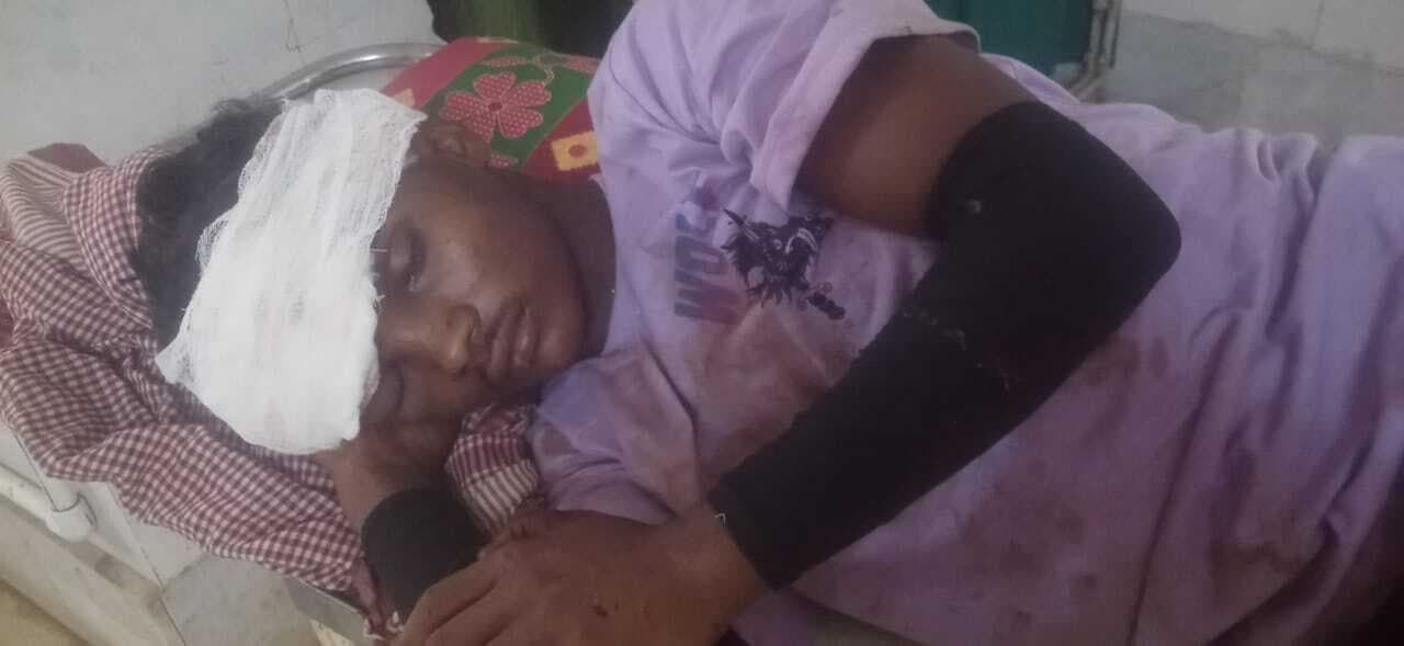 Chaibasa News : कुमारडुंगी में दो बाइकों में भिड़ंत, एक की मौत, दो घायल