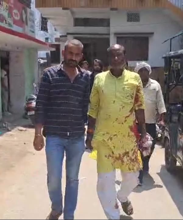 जमीन व रास्ते के विवाद में फायरिंग, ईंट व पिस्तौल के बट से मार कर तीन को किया जख्मी