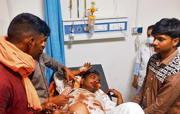 siwan news. गंभीर घायल को बिना टांका लगाये दो इंजेक्शन देकर किया रेफर