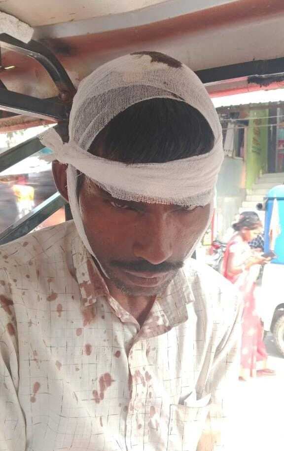 जमीन बंटवारे को लेकर मारपीट, दो लोग घायल