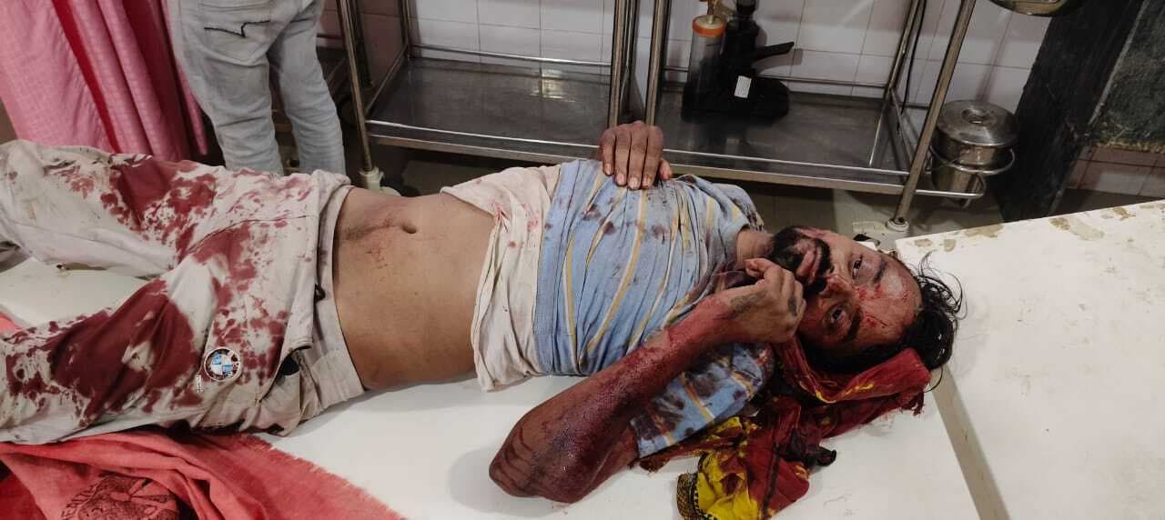 अज्ञात वाहन के चपेट में आने से युवक हुआ जख्मी, रेफर