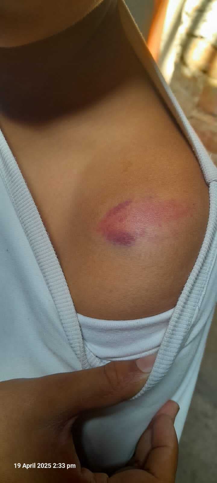 बीइओ से एमडीएम नहीं मिलने की कही बात, तो भड़के एचएम ने बच्चों को पीटा