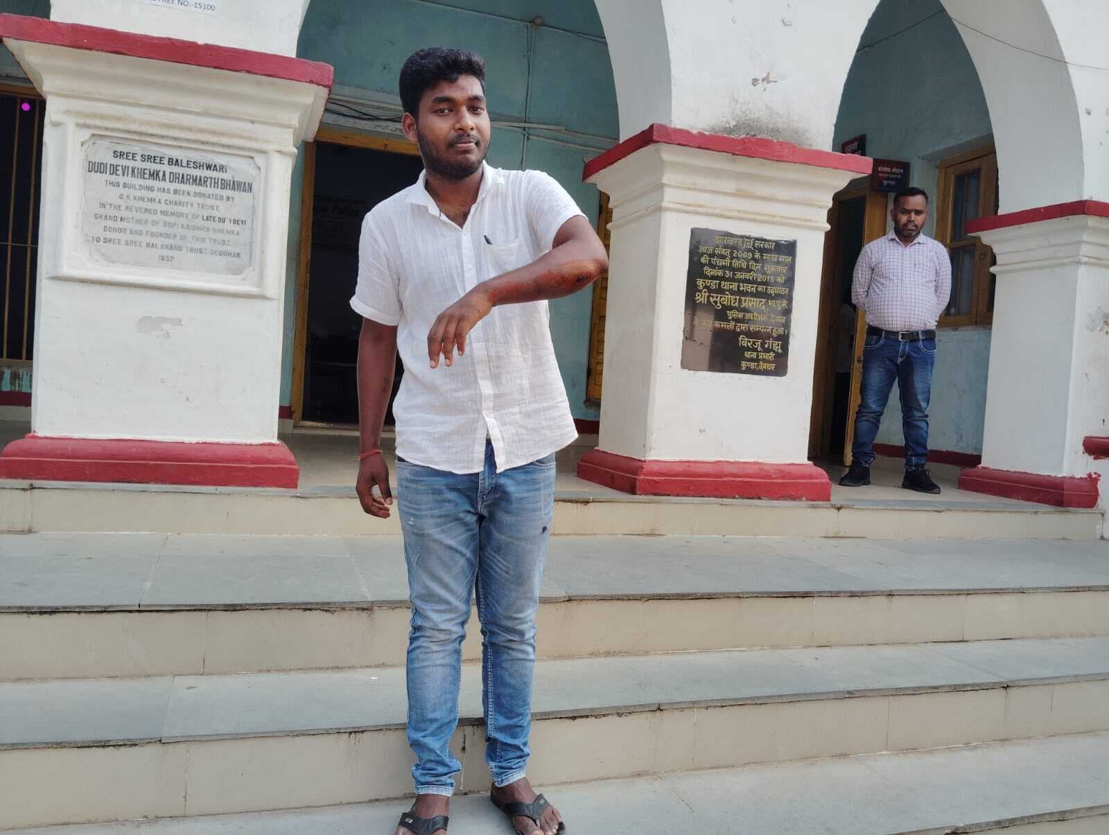 deoghar news : रंगदारी नहीं देने पर तोबड़तोड़ फायरिंग, दवा दुकानदार के हाथ को छूकर निकली गोली