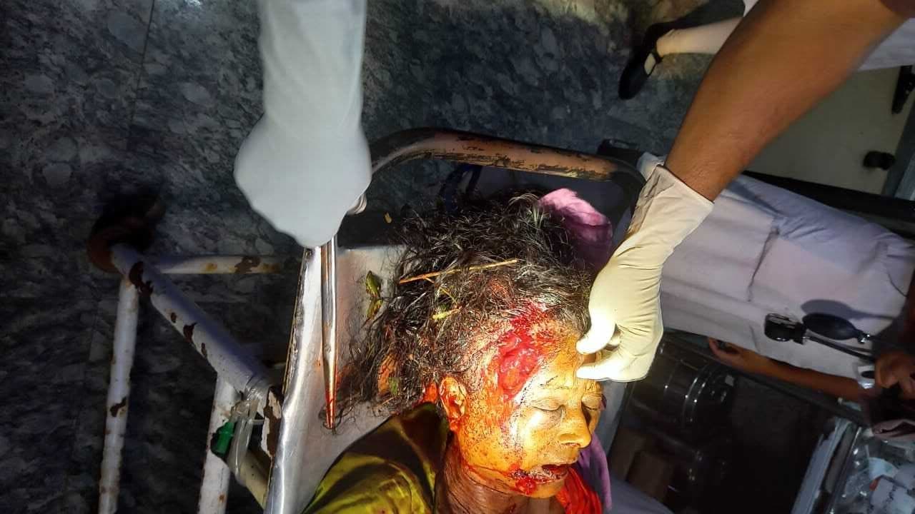 East Singhbhum News : झाड़ग्राम में हाथियों के हमले में व्यक्ति की मौत, महिला गंभीर