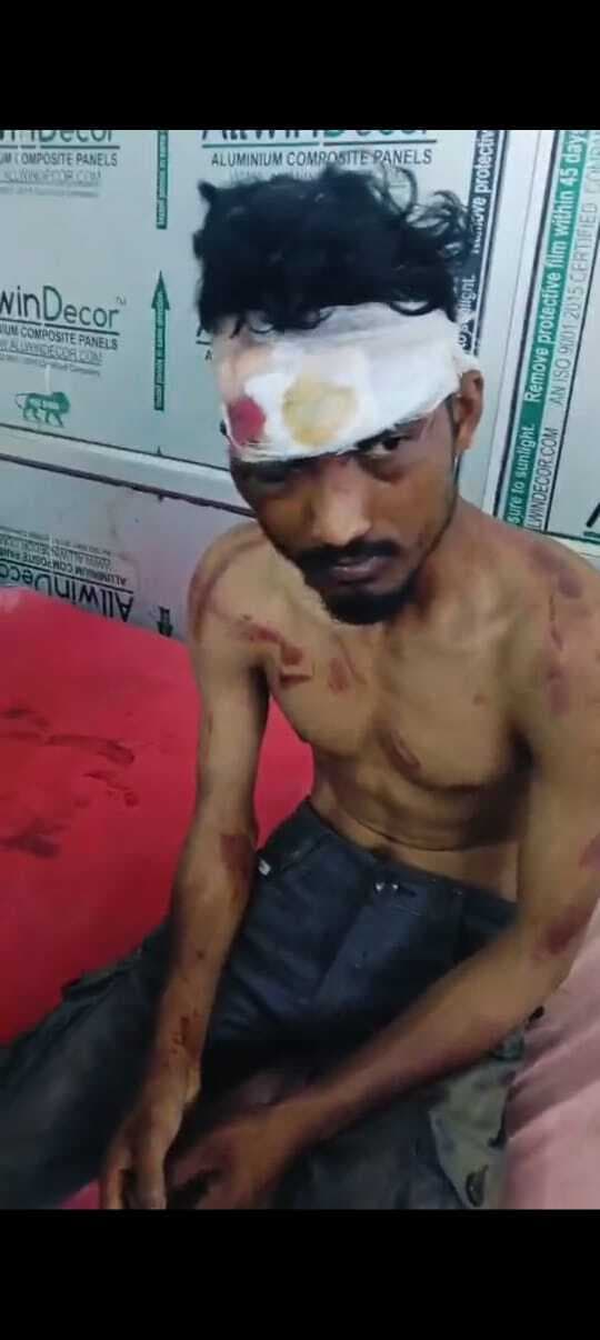 East Singhbhum News : उधार के पैसे मांगने पर जादूगोड़ा के युवक को पीटा, रेल लाइन पर फेंकने जा रहे थे, भागकर बचायी जान